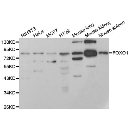 Western blot - FOXO1 antibody from Signalway Antibody (38499) - Antibodies.com