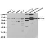 Western blot - FOXO1 antibody from Signalway Antibody (38499) - Antibodies.com