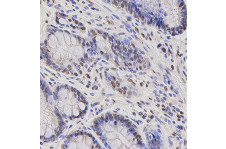 Immunohistochemistry - FOXO1 antibody from Signalway Antibody (38499) - Antibodies.com