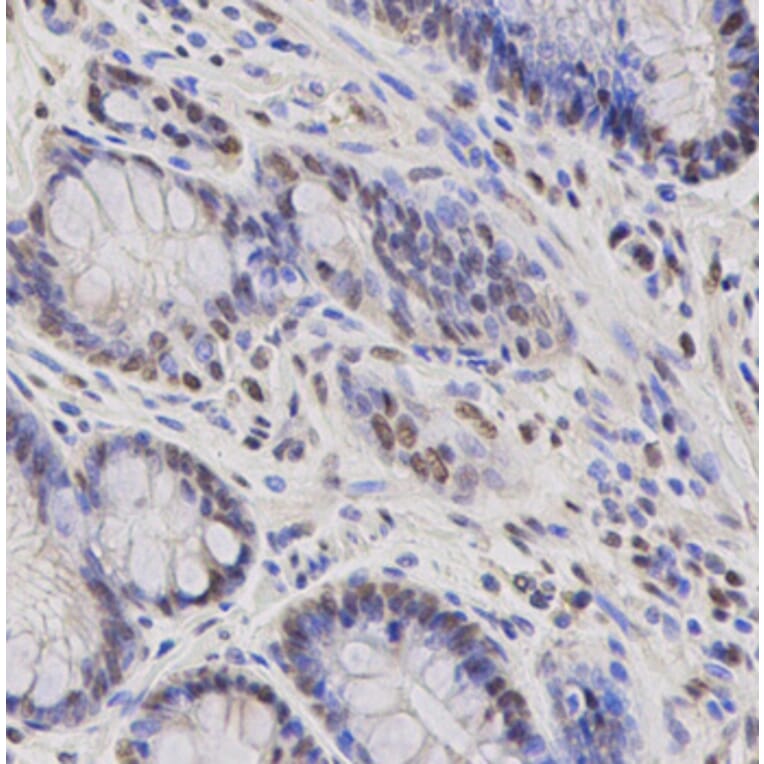 Immunohistochemistry - FOXO1 antibody from Signalway Antibody (38499) - Antibodies.com