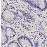 Immunohistochemistry - FOXO1 antibody from Signalway Antibody (38499) - Antibodies.com