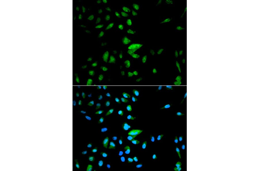 Immunofluorescence - FOXO1 antibody from Signalway Antibody (38499) - Antibodies.com
