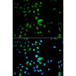 Immunofluorescence - FOXO1 antibody from Signalway Antibody (38499) - Antibodies.com