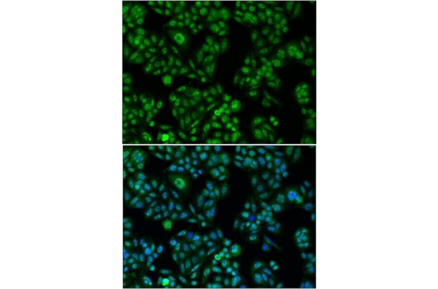 Immunofluorescence - FOXO1 antibody from Signalway Antibody (38499) - Antibodies.com