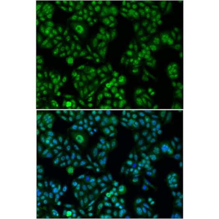 Immunofluorescence - FOXO1 antibody from Signalway Antibody (38499) - Antibodies.com