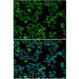 Immunofluorescence - FOXO1 antibody from Signalway Antibody (38499) - Antibodies.com