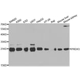 Western blot - PRDX3 antibody from Signalway Antibody (38567) - Antibodies.com