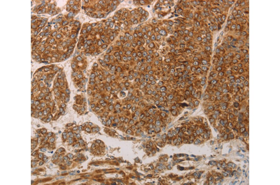 Immunohistochemistry - PRDX3 antibody from Signalway Antibody (38567) - Antibodies.com