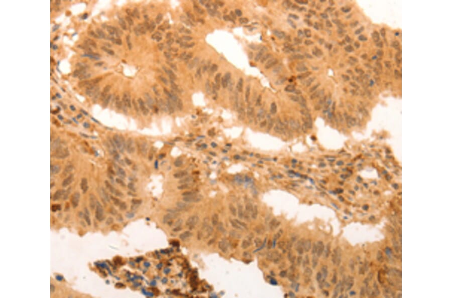 Immunohistochemistry - SUMO3 antibody from Signalway Antibody (38578) - Antibodies.com