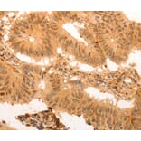 Immunohistochemistry - SUMO3 antibody from Signalway Antibody (38578) - Antibodies.com
