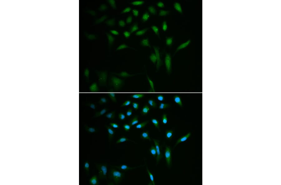Immunofluorescence - SUMO3 antibody from Signalway Antibody (38578) - Antibodies.com