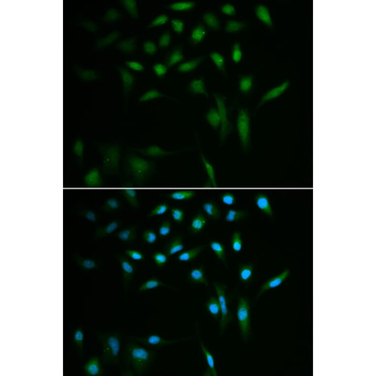 Immunofluorescence - SUMO3 antibody from Signalway Antibody (38578) - Antibodies.com