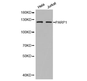Western blot - PARP1 antibody from Signalway Antibody (38592) - Antibodies.com