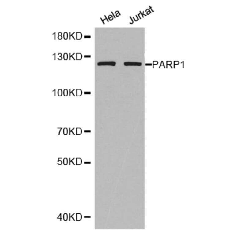 Western blot - PARP1 antibody from Signalway Antibody (38592) - Antibodies.com