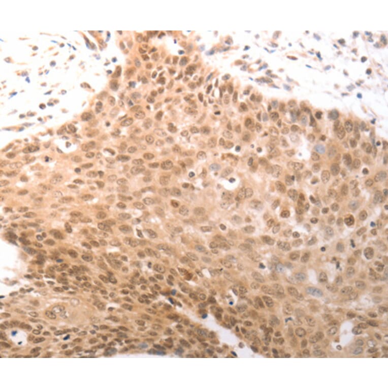 Immunohistochemistry - PARP1 antibody from Signalway Antibody (38592) - Antibodies.com