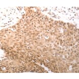Immunohistochemistry - PARP1 antibody from Signalway Antibody (38592) - Antibodies.com