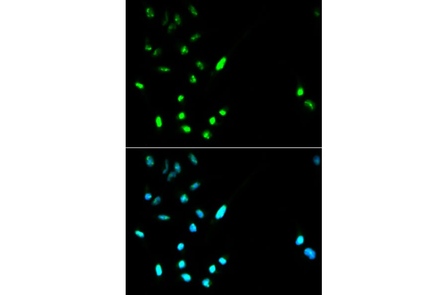 Immunofluorescence - PARP1 antibody from Signalway Antibody (38592) - Antibodies.com