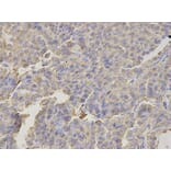 Immunohistochemistry - FABP3 antibody from Signalway Antibody (38641) - Antibodies.com