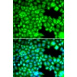 Immunofluorescence - FABP3 antibody from Signalway Antibody (38641) - Antibodies.com