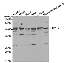 Western blot - SMYD5 antibody from Signalway Antibody (38742) - Antibodies.com