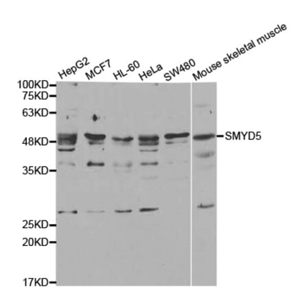 Western blot - SMYD5 antibody from Signalway Antibody (38742) - Antibodies.com