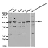 Western blot - SMYD5 antibody from Signalway Antibody (38742) - Antibodies.com
