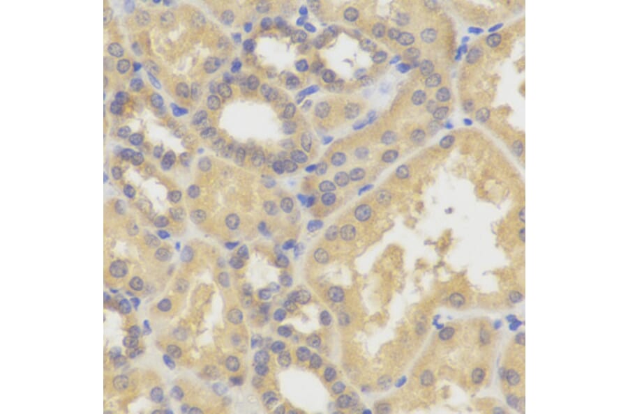 Immunohistochemistry - SMYD5 antibody from Signalway Antibody (38742) - Antibodies.com