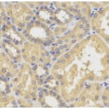 Immunohistochemistry - SMYD5 antibody from Signalway Antibody (38742) - Antibodies.com