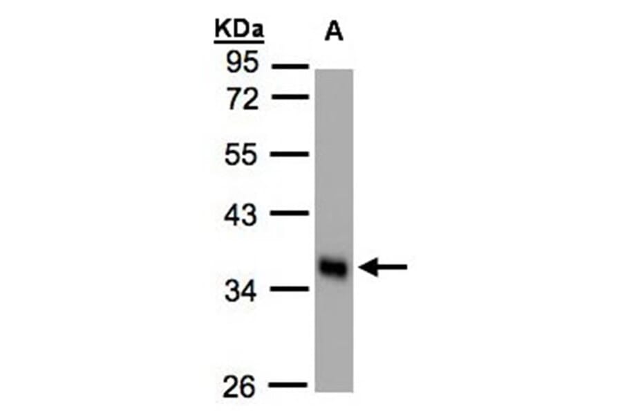phospholipid scramblase 1 antibody from Signalway Antibody (22435) - Antibodies.com