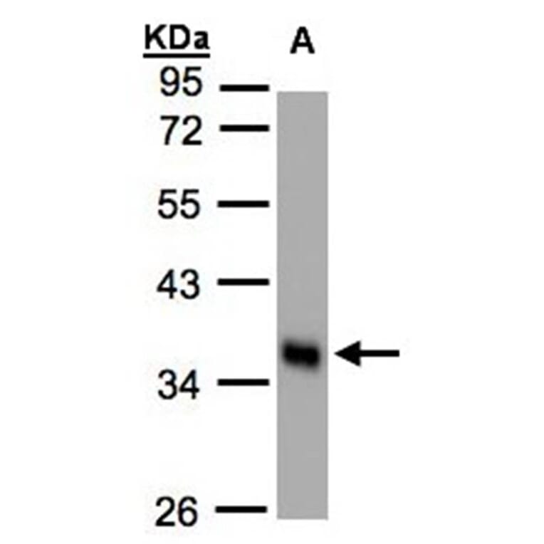 phospholipid scramblase 1 antibody from Signalway Antibody (22435) - Antibodies.com