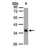 phospholipid scramblase 1 antibody from Signalway Antibody (22435) - Antibodies.com