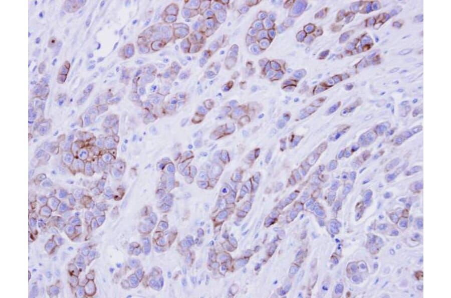 Immunohistochemistry - phospholipid scramblase 1 antibody from Signalway Antibody (22435) - Antibodies.com