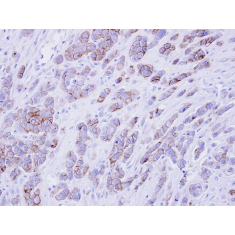 Immunohistochemistry - phospholipid scramblase 1 antibody from Signalway Antibody (22435) - Antibodies.com