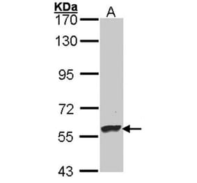 Dopamine beta-Hydroxylase antibody from Signalway Antibody (22483) - Antibodies.com