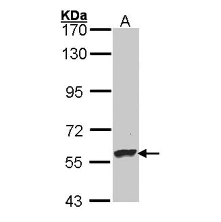 Dopamine beta-Hydroxylase antibody from Signalway Antibody (22483) - Antibodies.com