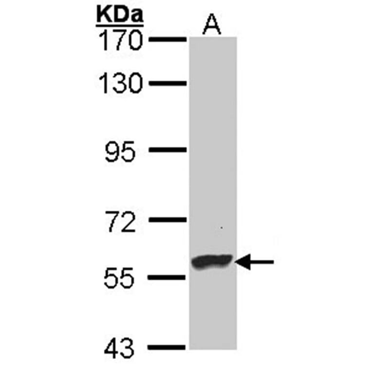 Dopamine beta-Hydroxylase antibody from Signalway Antibody (22483) - Antibodies.com