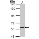 Dopamine beta-Hydroxylase antibody from Signalway Antibody (22483) - Antibodies.com
