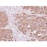 Immunohistochemistry - Dopamine beta-Hydroxylase antibody from Signalway Antibody (22483) - Antibodies.com