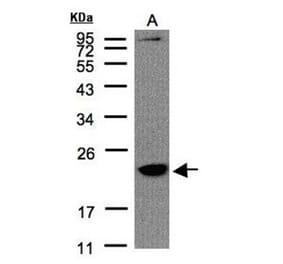 Transmembrane protein 147 antibody from Signalway Antibody (23105) - Antibodies.com