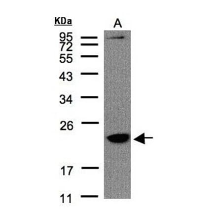 Transmembrane protein 147 antibody from Signalway Antibody (23105) - Antibodies.com