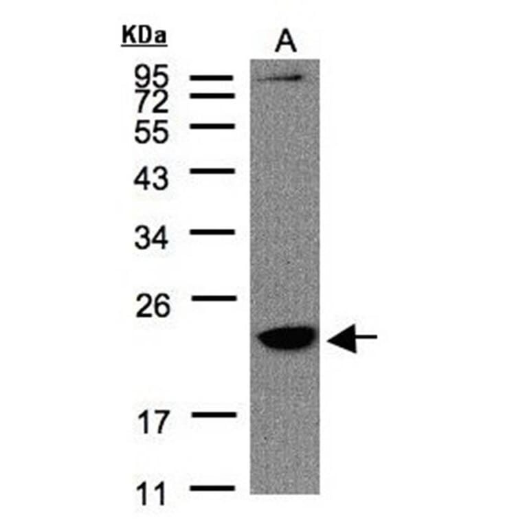 Transmembrane protein 147 antibody from Signalway Antibody (23105) - Antibodies.com