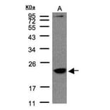 Transmembrane protein 147 antibody from Signalway Antibody (23105) - Antibodies.com