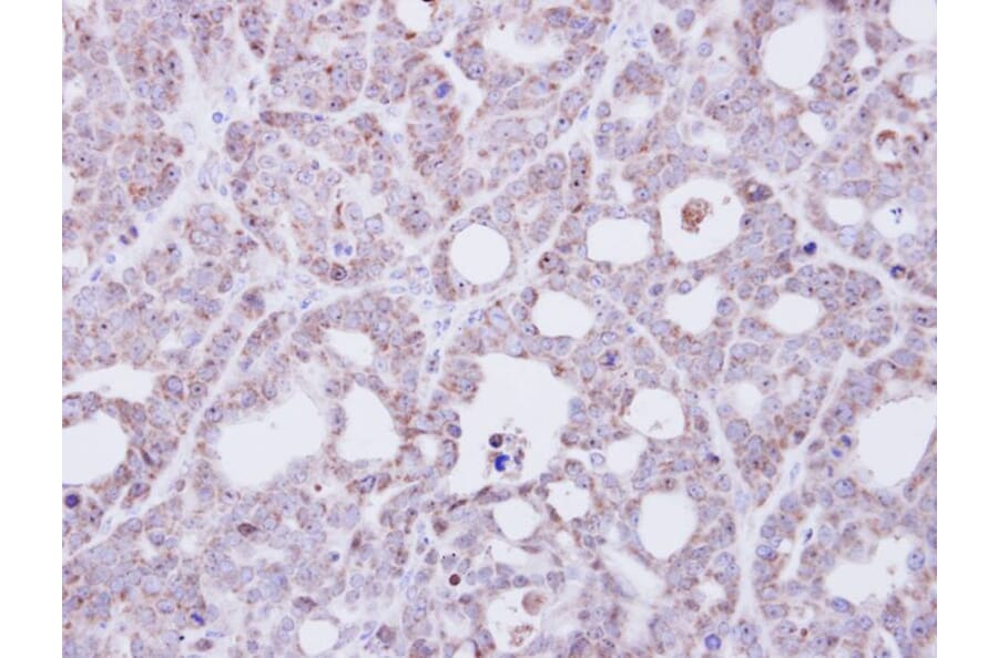 Immunohistochemistry - Transmembrane protein 147 antibody from Signalway Antibody (23105) - Antibodies.com
