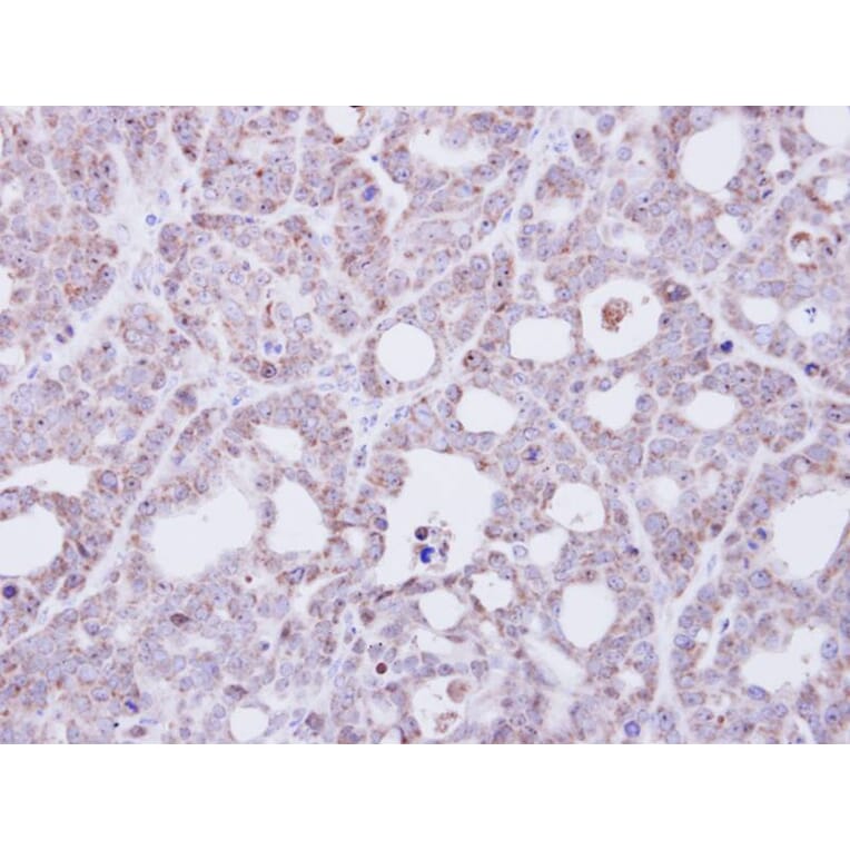 Immunohistochemistry - Transmembrane protein 147 antibody from Signalway Antibody (23105) - Antibodies.com