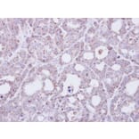 Immunohistochemistry - Transmembrane protein 147 antibody from Signalway Antibody (23105) - Antibodies.com