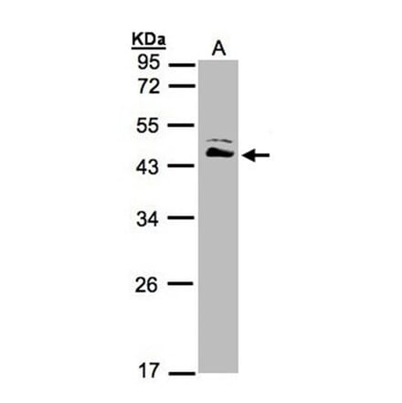 ASS1 antibody from Signalway Antibody (22017) - Antibodies.com