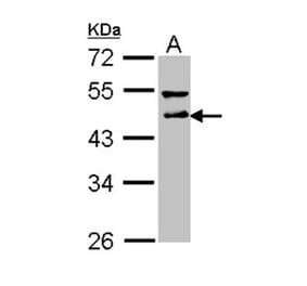 DLST antibody from Signalway Antibody (22024) - Antibodies.com