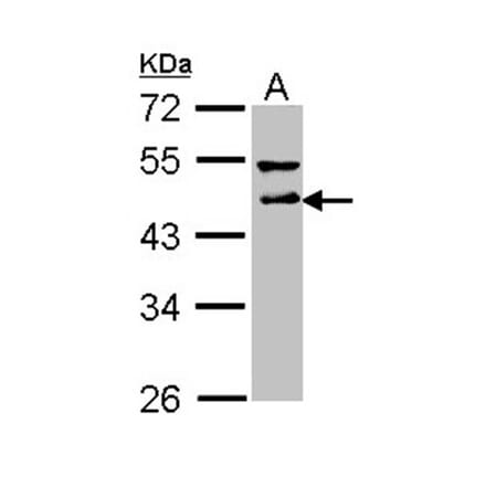 DLST antibody from Signalway Antibody (22024) - Antibodies.com