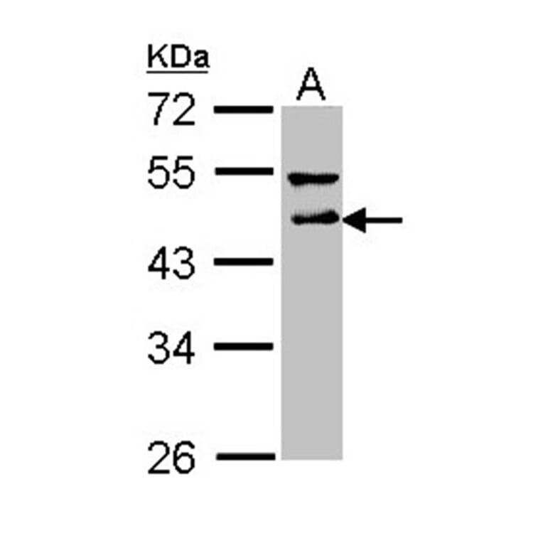 DLST antibody from Signalway Antibody (22024) - Antibodies.com
