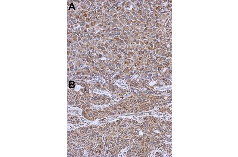 Immunohistochemistry - DLST antibody from Signalway Antibody (22024) - Antibodies.com
